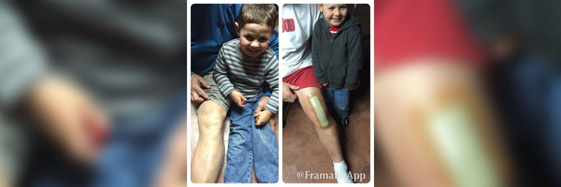 Robert - Spine and Knee Surgery