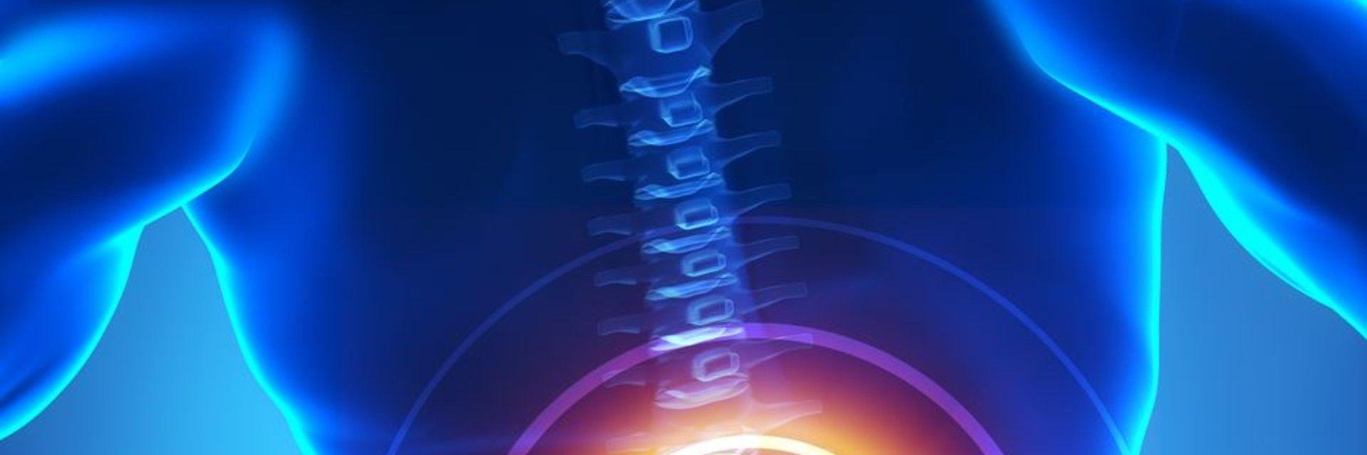 Do I Need Spinal Fusion Surgery?