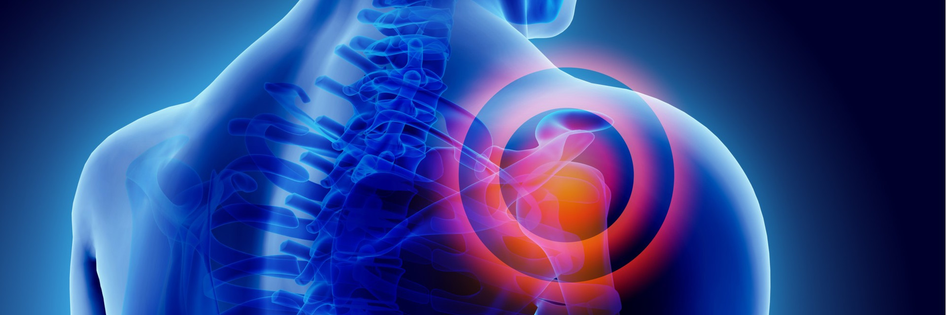 Three Key Wintertime Risks of Damage to the Shoulder Joint