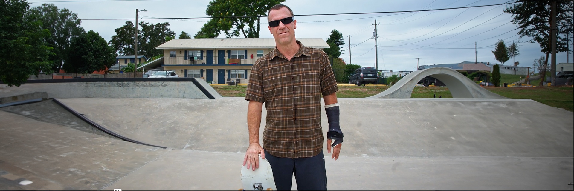 John's Story - Left Ankle Replacement