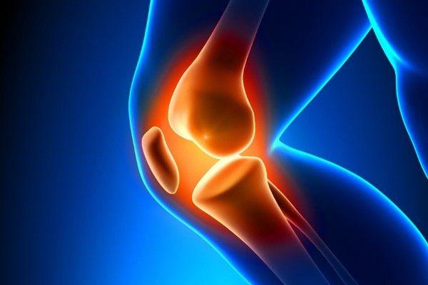 Dealing With Arthritis in Knee Joints