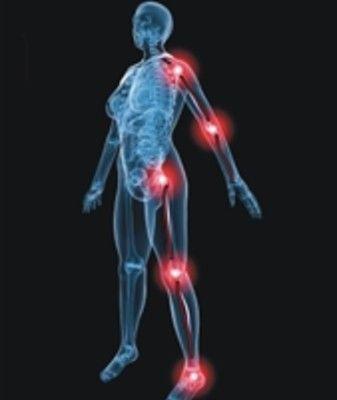 Arm or Leg Pain Without Weakness: Causes and Solutions