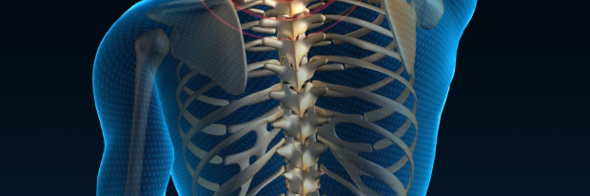 Frequently Asked Questions About Anterior Cervical Fusion Surgery