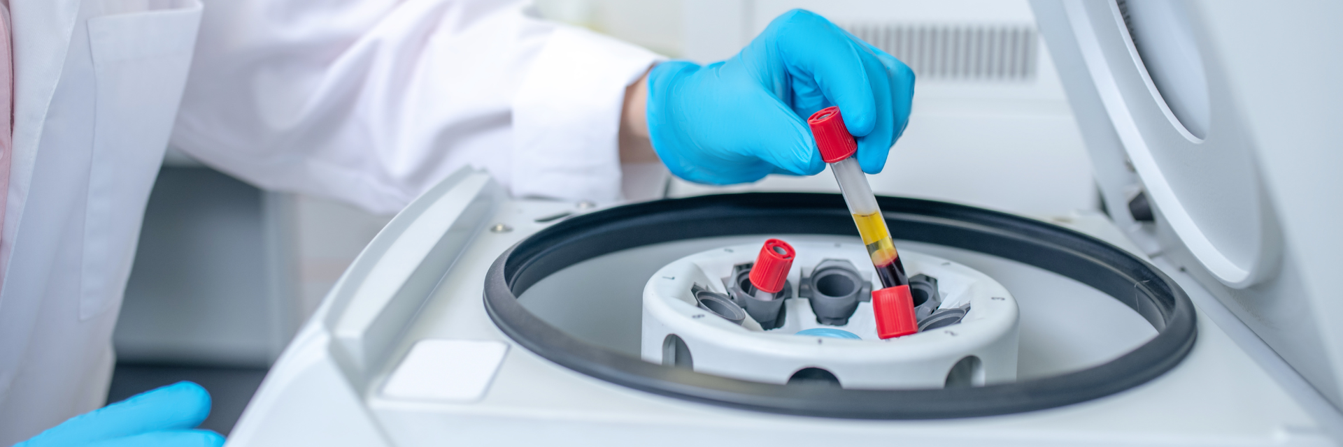 Platelet Rich Plasma Paradigm: Innovations in Sports Injury Recovery