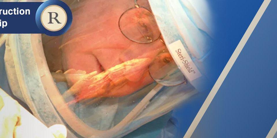 Adult Reconstruction Fellowship (Philadelphia)